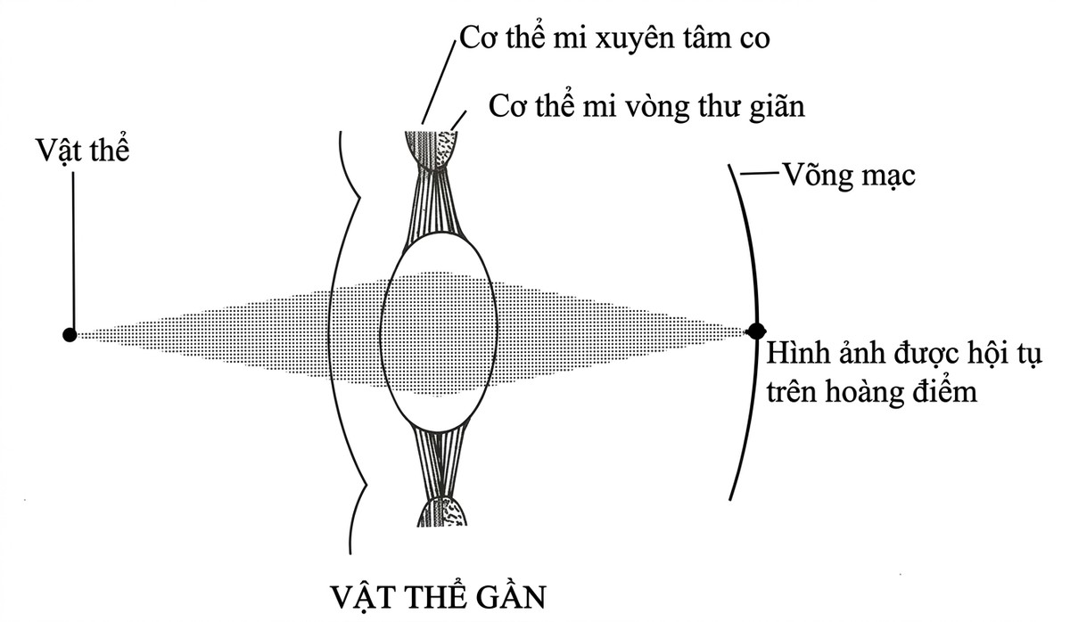 esoteric-anatomy-part-one-song-ngu_upscaled_20260719_061357-29.webp 00078.jpg
