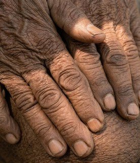 phan-ii-cac-dau-hieu-new-18.jpg Close-up of hands on a person's knee
AI-generated content may be incorrect.