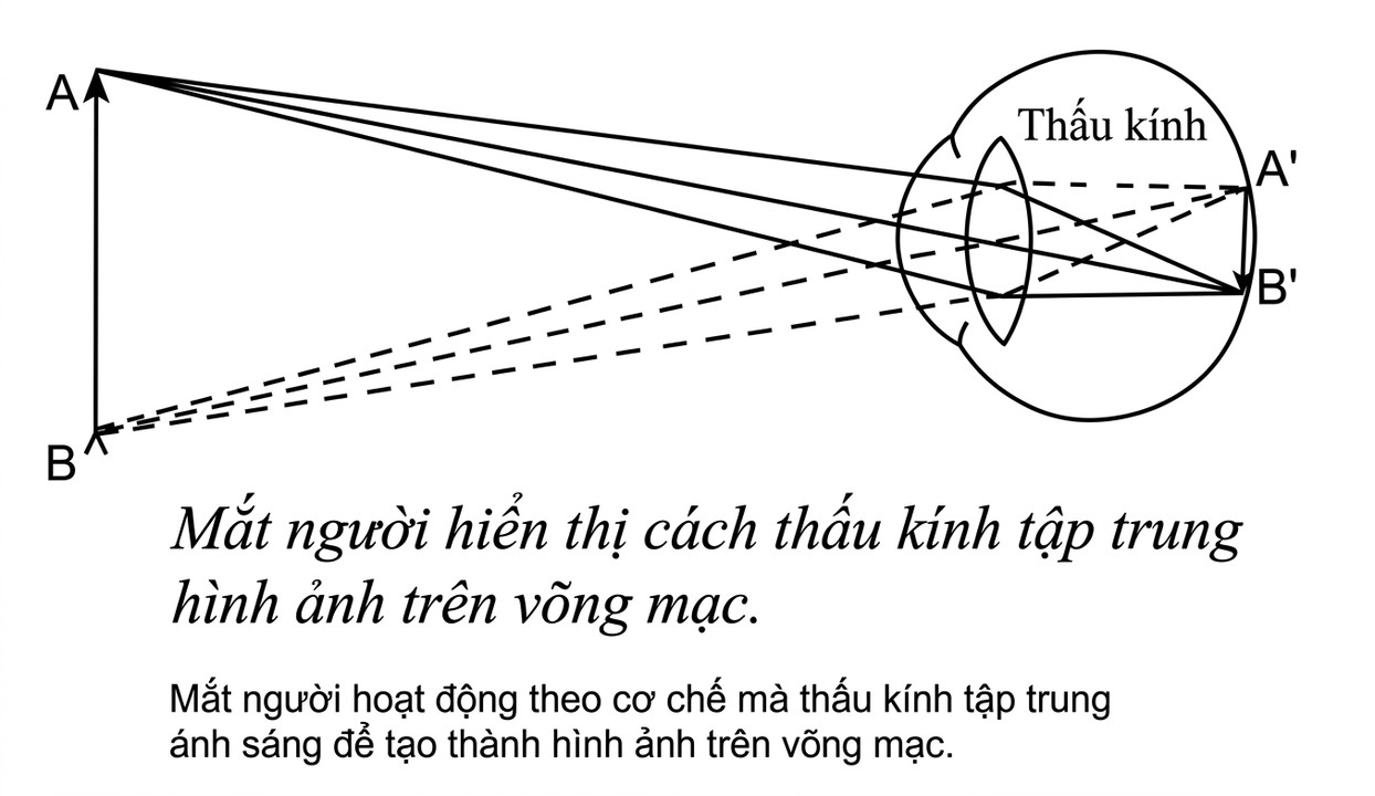 the-opening-of-the-third-eye-douglas-baker-song-ngu_upscaled_20260719_022025-26.webp A diagram of a human eye
Description automatically generated